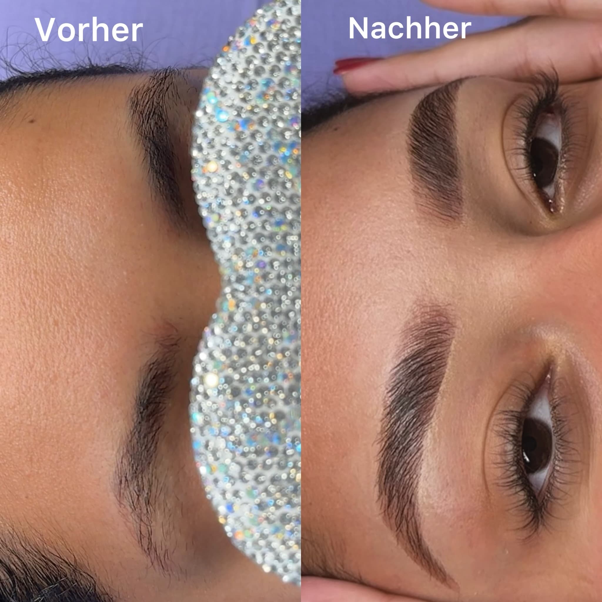 Brow Lift - Brow Lifting für formschöne Augenbrauen